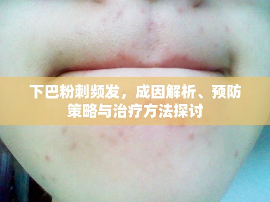 下巴粉刺頻發(fā)，成因解析、預(yù)防策略與治療方法探討