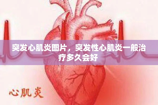 突發(fā)心肌炎圖片，突發(fā)性心肌炎一般治療多久會(huì)好 