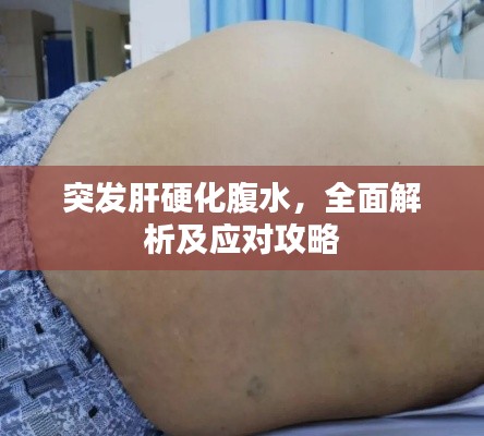 突發(fā)肝硬化腹水，全面解析及應對攻略