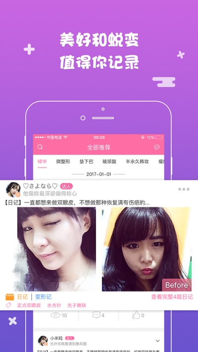 米團(tuán)網(wǎng)官方下載,動(dòng)態(tài)說(shuō)明分析-特別款_v8.527